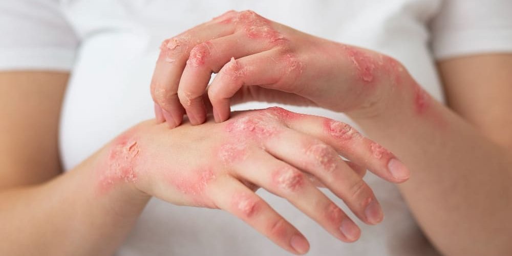 understanding fungal infections