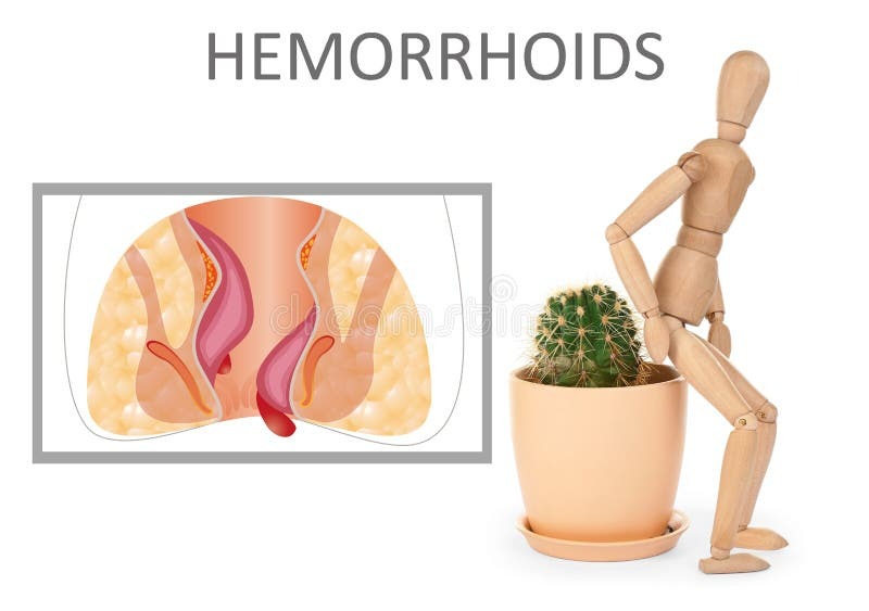 hemorrhoids wooden human figure
